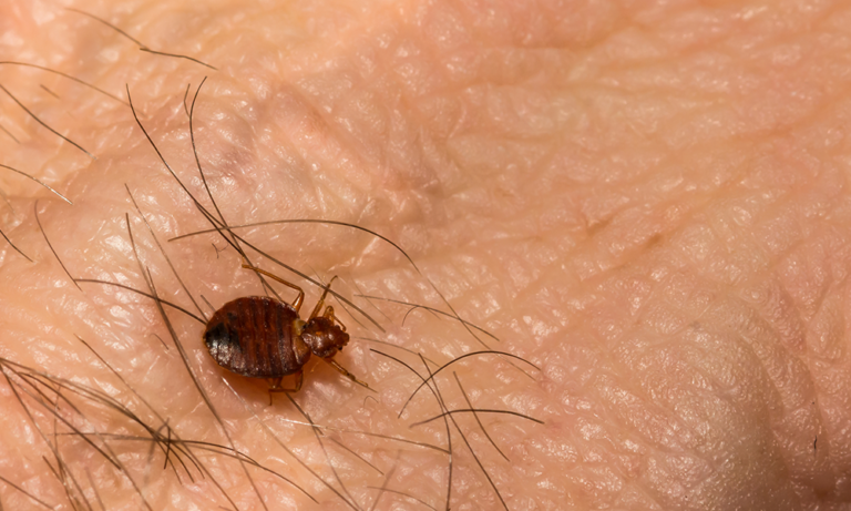 You-may-have-seen-eggs-on-your-skin-if-you-have-bed-bugs